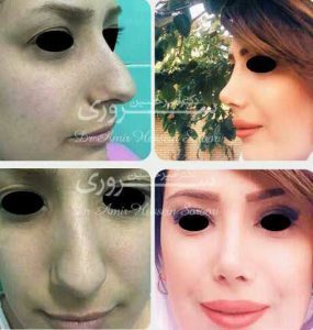 دکتر امیرحسین سروری هزینه۵/۵ میلیون
