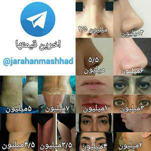تلگرام-بهترین-جراح-عمل-بینی-زیبایی-مشهد